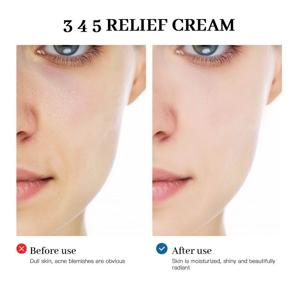 345 Relief Crem | Solução Completa para Problemas de Pele, Anti-Açúcar e Antioxidante, Clareia a Pele Melhora Marcas de Acne
